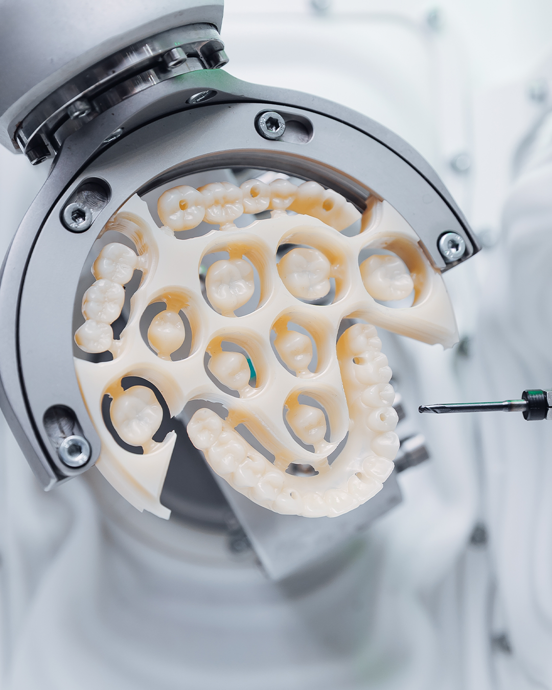 Full Mouth Restoration