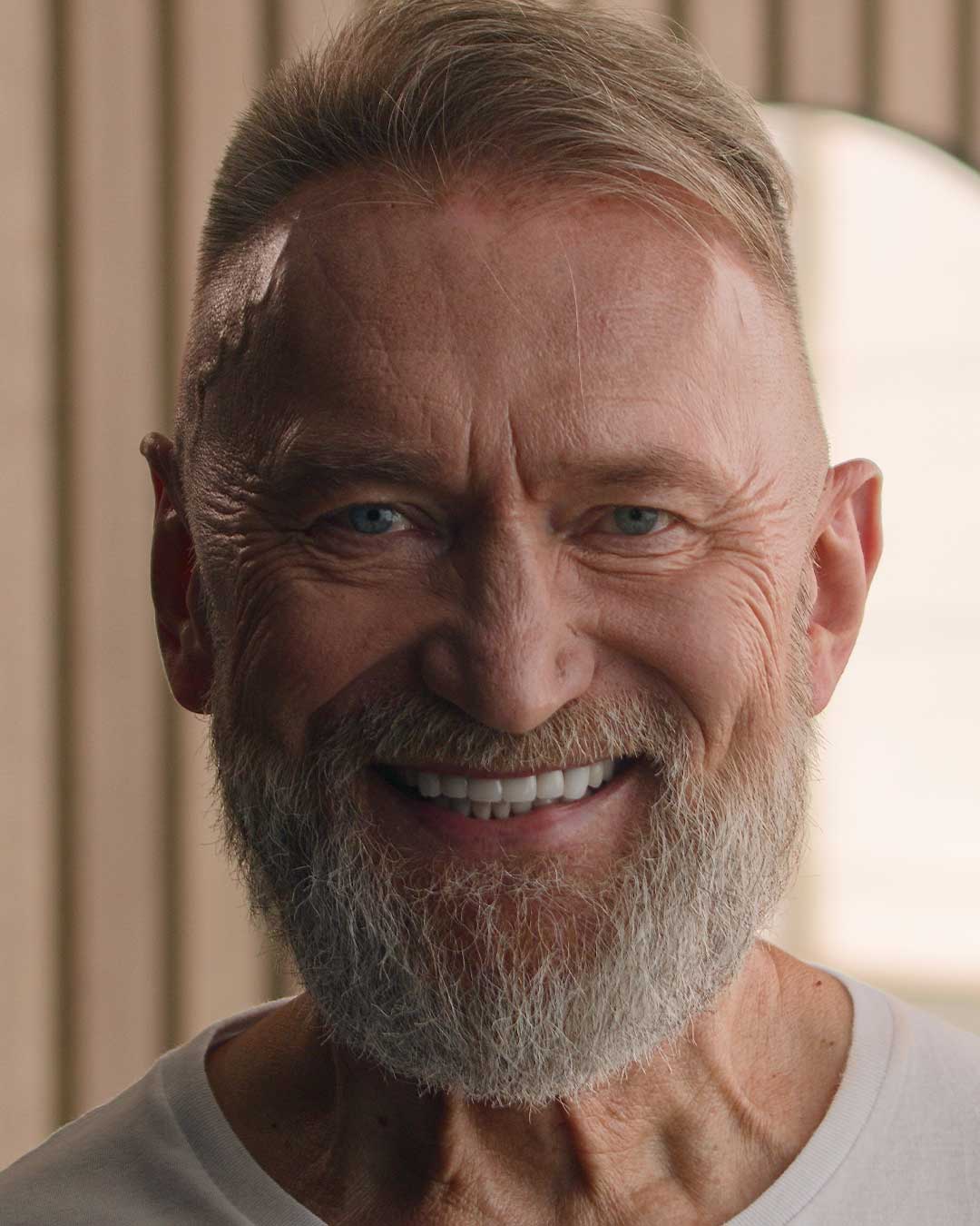 Full Mouth Restoration Patient